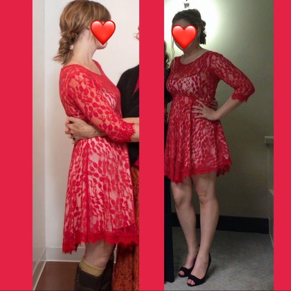 Free People Boho Lace Dress - Picture 8 of 9